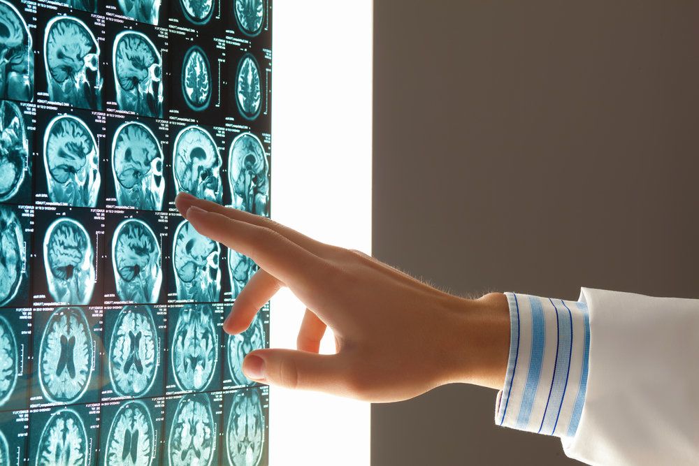 doctor examining x-rays